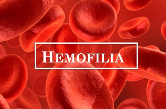 Hemofilia – co wiemy o tej chorobie?