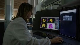 Synapse 3D ułatwia zarządzanie diagnostyką pacjentów podczas pandemii COVID19